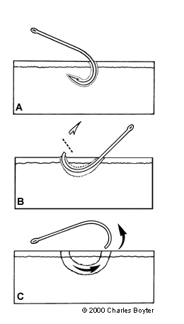 Treble Hook Removal | Fishing Safety | Texoma Guide John Blasingame